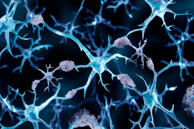 چرا مبتلایان به سرطان از آلزایمر مصون‌اند؟